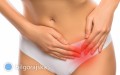 5 przyczyn bólu w jajnikach