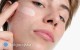 Problemy sk�rne a&nbsp;styl �ycia - co naprawd� wp�ywa na kondycj� sk�ry?